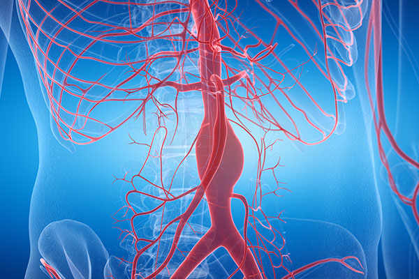 Vascular Care Specialists | Dialysis Access, Venous Insufficiency and Peripheral Artery Disease  PAD 