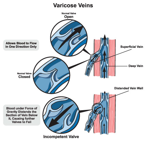 Vascular Care Specialists | Dialysis Access, Vascular Ultrasound and Peripheral Artery Disease  PAD 