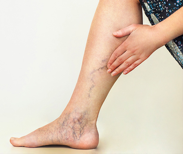Vascular Care Specialists | Vein Treatments, Venous Disease and Carotid Artery Disease